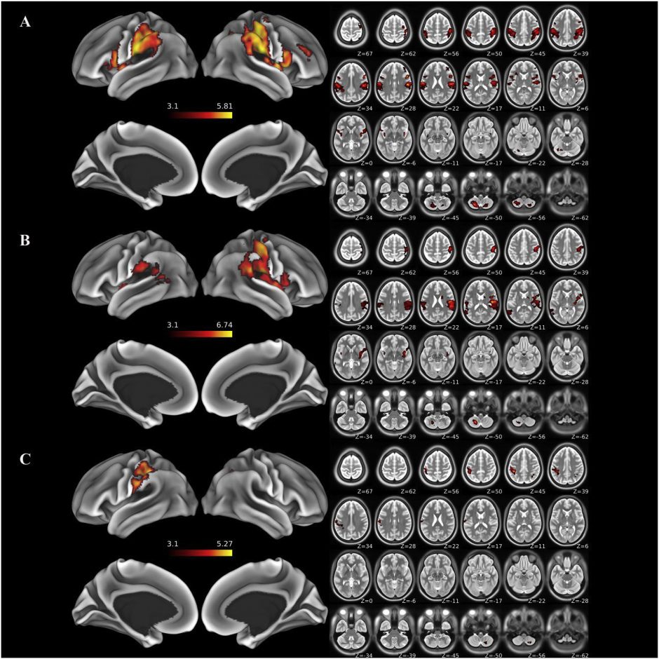 Whole-brain functional MRI analysis
