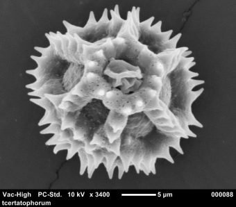 A microscopic view of spiny pollen